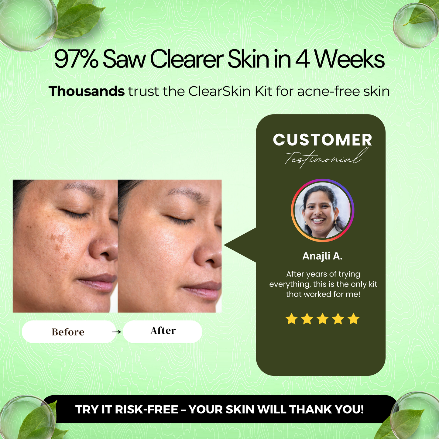 ClearSkin Acne Reduction Kit
