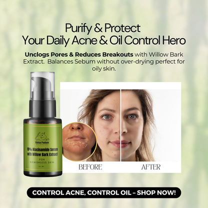 10% Niacinamide Serum with Willow Bark Extract